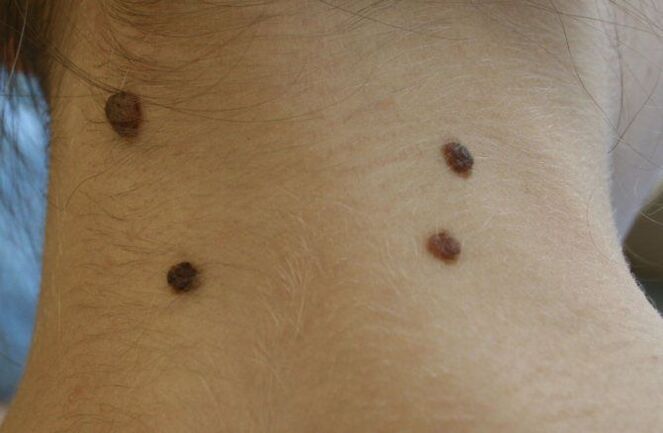 a large number of moles